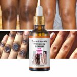Dark Knuckle Corrector Serum Gallery Image - AFRO-WHITE