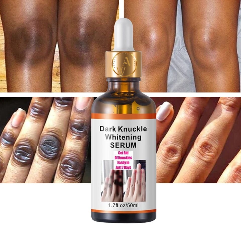 Dark Knuckle Corrector Serum Gallery Image - AFRO-WHITE