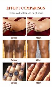 Dark Knuckle Corrector Serum Gallery Image - AFRO-WHITE