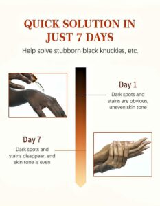 Dark Knuckle Corrector Serum Gallery Image - AFRO-WHITE