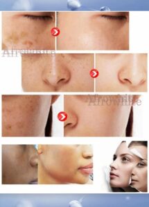 Glutathione Collagen 2 Gallery Image - AFRO-WHITE