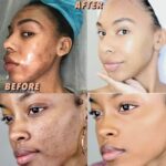 Gt Glutathione Soap Gallery Image - AFRO-WHITE