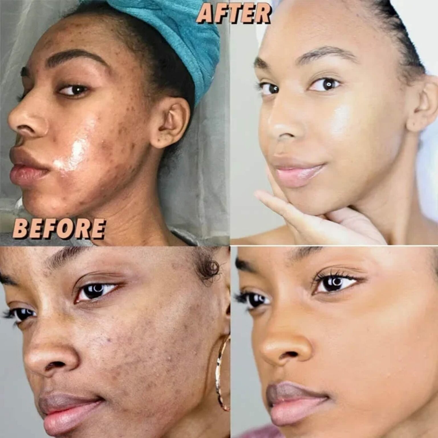 Gt Glutathione Soap Gallery Image - AFRO-WHITE