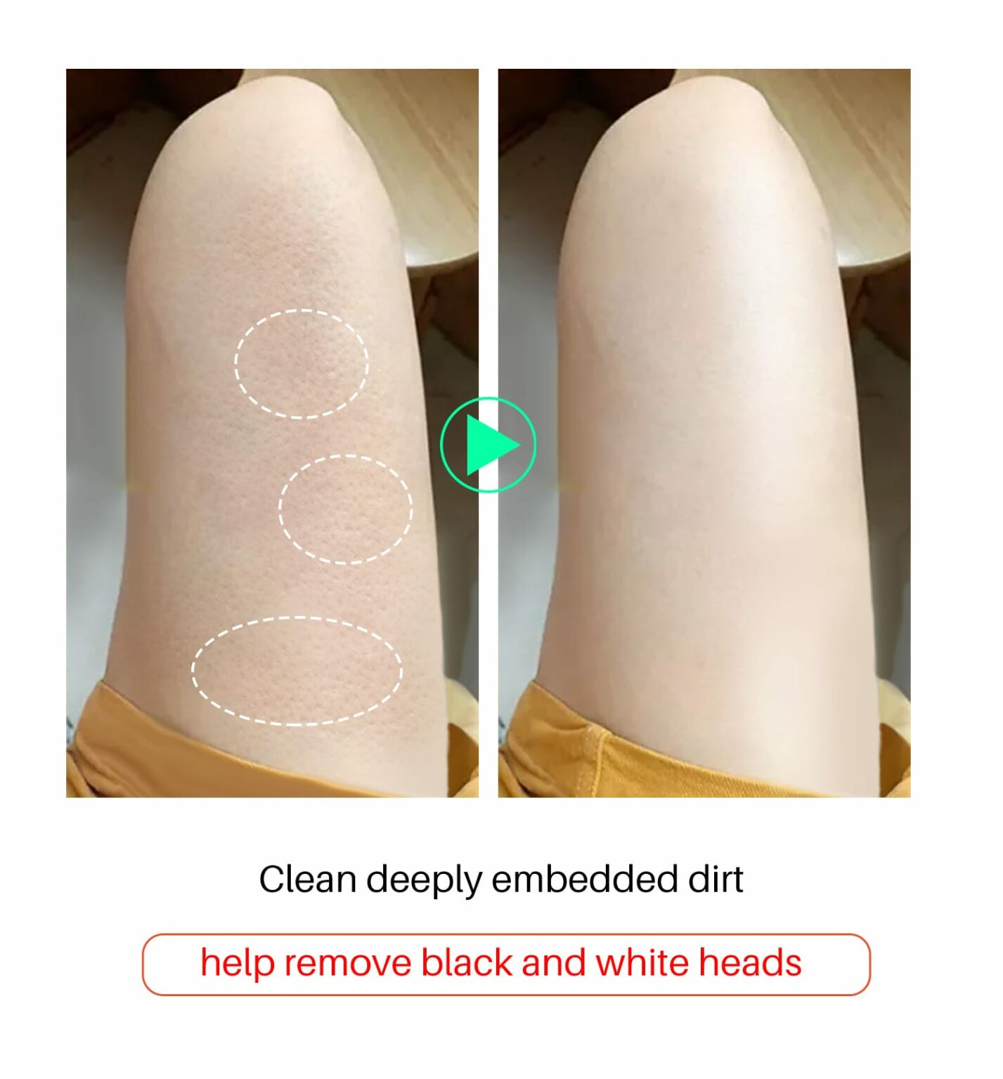 Lanthome Glutathione Soap Gallery Image - AFRO-WHITE