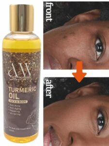 Turmeric Oil Gallery Image - AFRO-WHITE